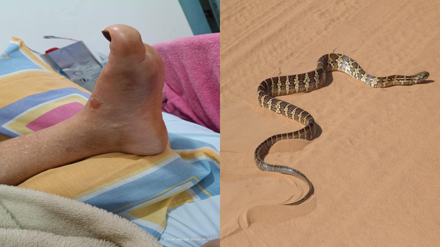 Cobra jararacuçu pica mulher em fazenda de Paraíso das Águas e mobiliza atendimento com apoio em Chapadão do Sul